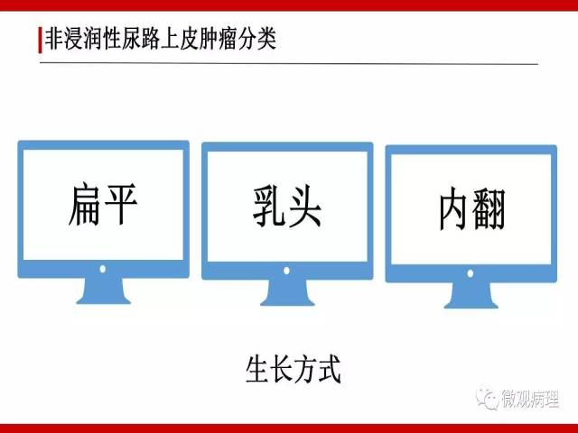 泌尿课程/非浸润性尿路上皮肿瘤诊断公式