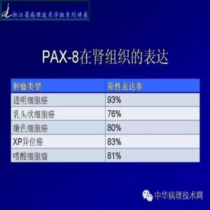 免疫组化结果的分析和常见问题的处理