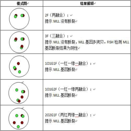 血液肿瘤FISH检测判读建议(二): 基因断裂