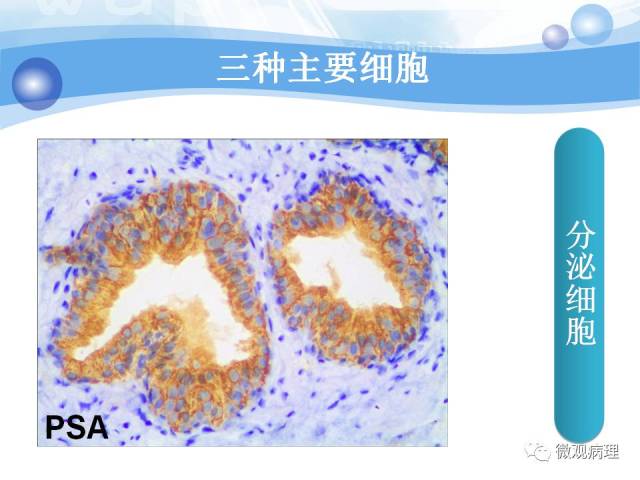正常前列腺组织学