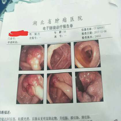 精准的病理诊断，才有精准的治疗