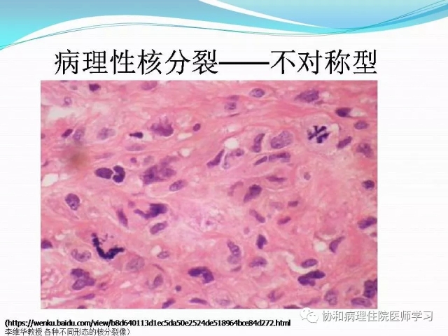 病理学基础知识 : 核分裂像的识别