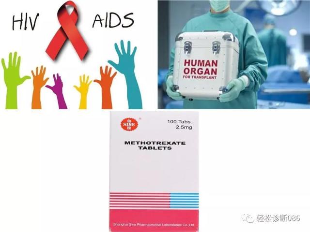 免疫缺陷相关淋巴组织增殖性疾病