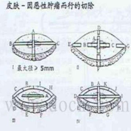 病理标本取材规范