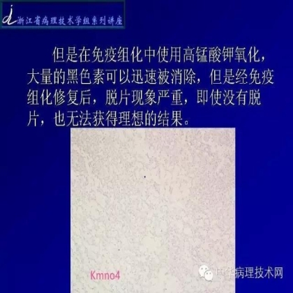 黑色素免疫组化的处理