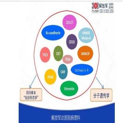 肾上皮性肿瘤免疫组化诊断基本流程