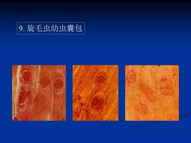 收藏！寄生虫图谱大全