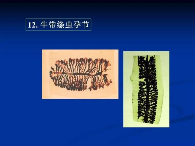 收藏！寄生虫图谱大全