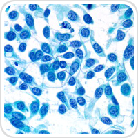 Webpathology.com-镜像翻译（自学使用，版权归原网站所有）