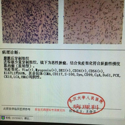 病理科新技术（二）：穿刺组织学明确诊断