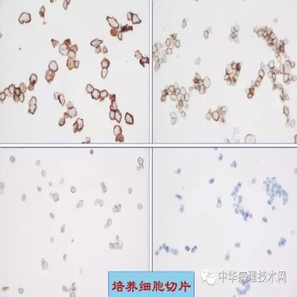 免疫组化液态阳性对照