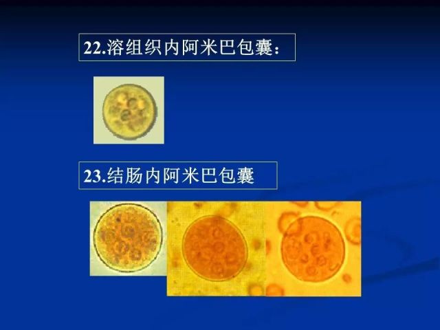 收藏！寄生虫图谱大全