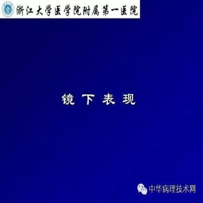 免疫组化液态阳性对照