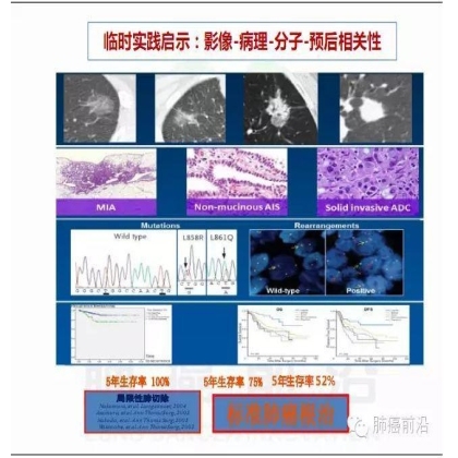肺癌新分期和分类--临床和研究启示