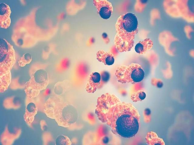 以甲状腺为例谈谈病理诊断那些事 以甲状腺为例谈谈病理诊断那些事