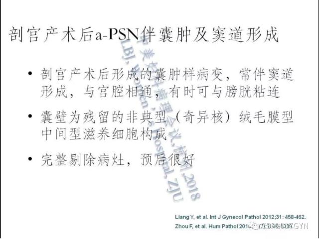 妊娠滋养细胞肿瘤的临床病理学进展
