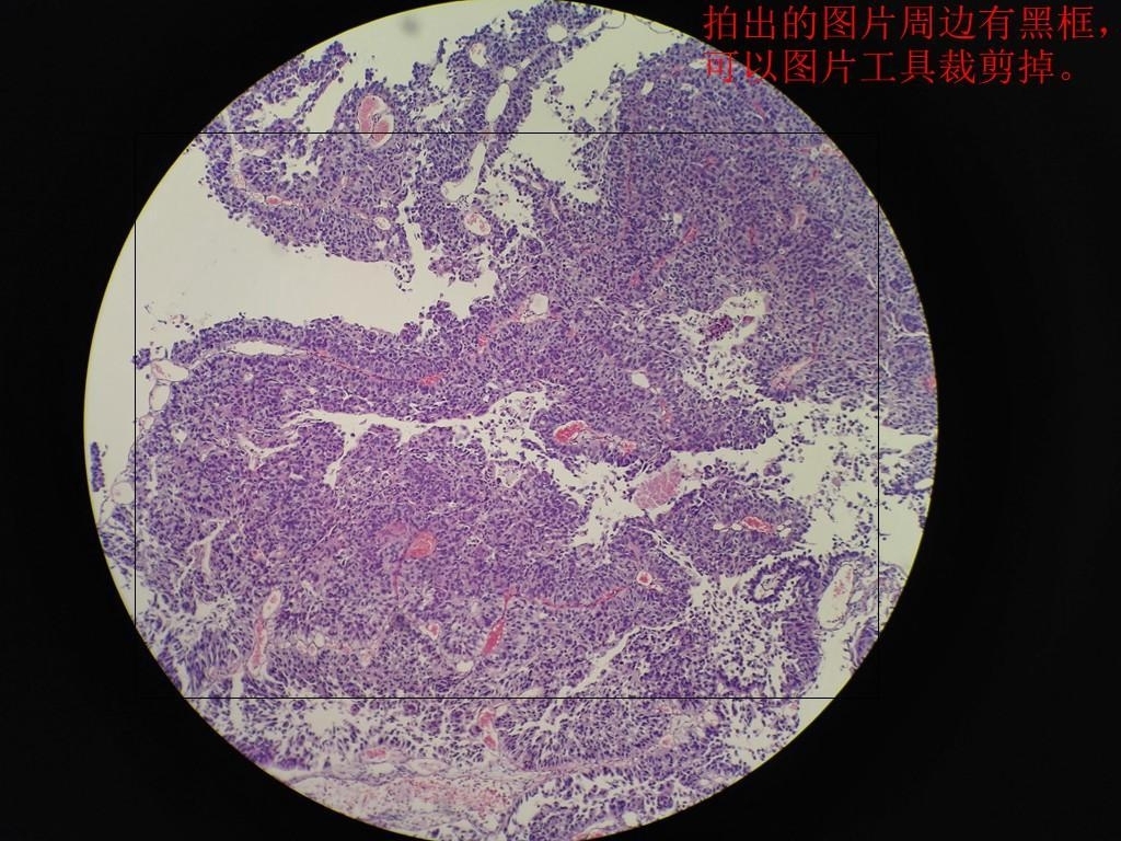 如何用手机对目镜拍出漂亮病理图片。