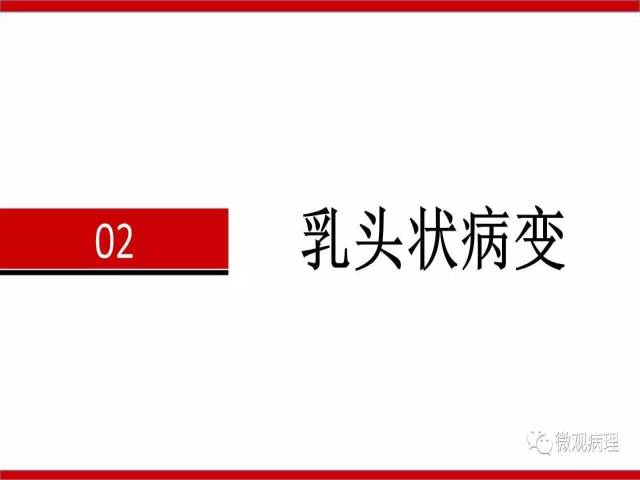 泌尿课程/非浸润性尿路上皮病变诊断的一些困惑
