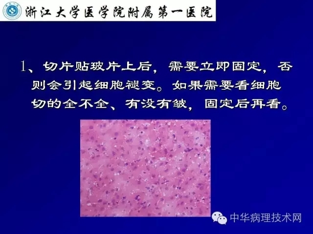 影响冰冻切片质量的原因（比赛注意事项）