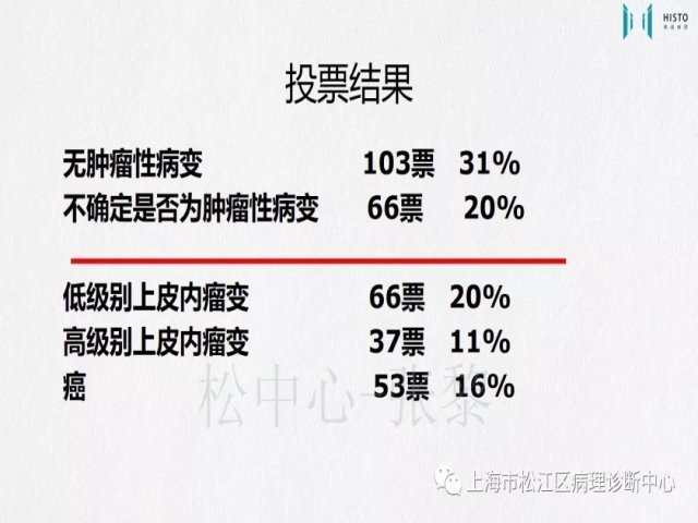 上消化道早癌病理诊断中的困惑及基本对策回顾