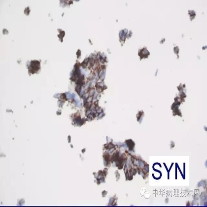 免疫组化液态阳性对照
