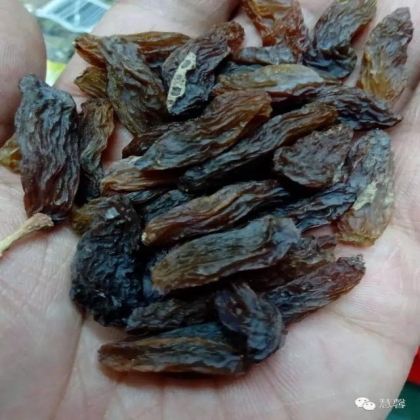 阴道鳞状上皮乳头状瘤？尖锐湿疣？（孔祥田老师病例分享，粉蓝医疗科技（杭州）有限公司女性生殖2群讨论，孔祥田(Max)*Roswell*老师讲解）
