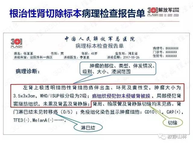 泌尿系统常见肿瘤标本病理报告规范