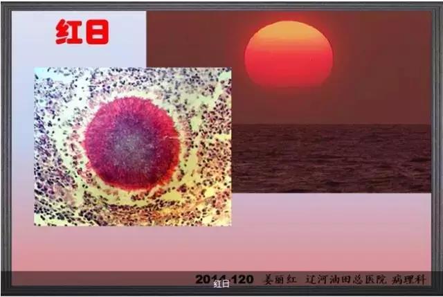 你见过这么美的病理切片吗？