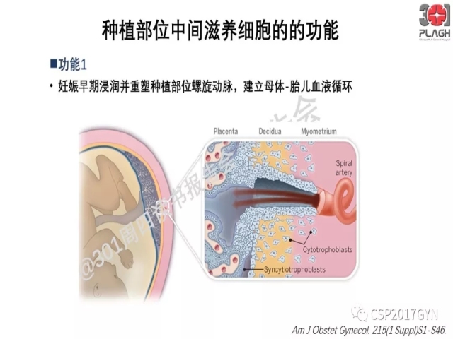 中间型滋养细胞肿瘤的诊断及鉴别诊断
