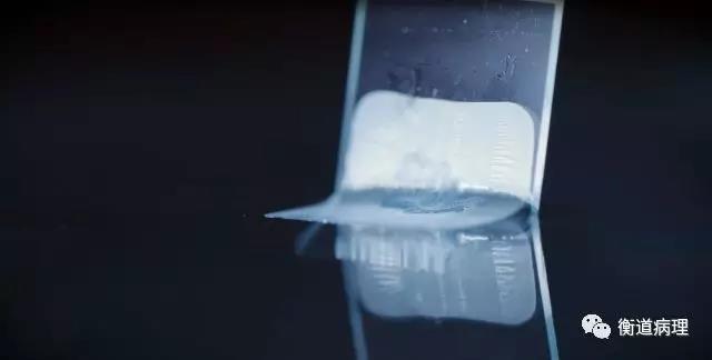 图片故事|我是一名病理技师
