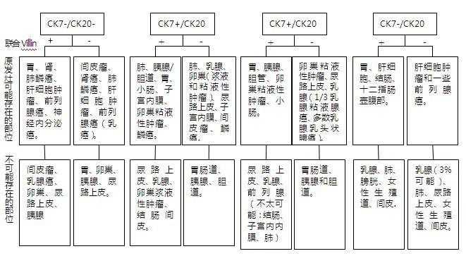 Cytokeratin7、Cytokeratin20和Villin的免疫组化联合标记在确定转移癌原发部位中的应用
