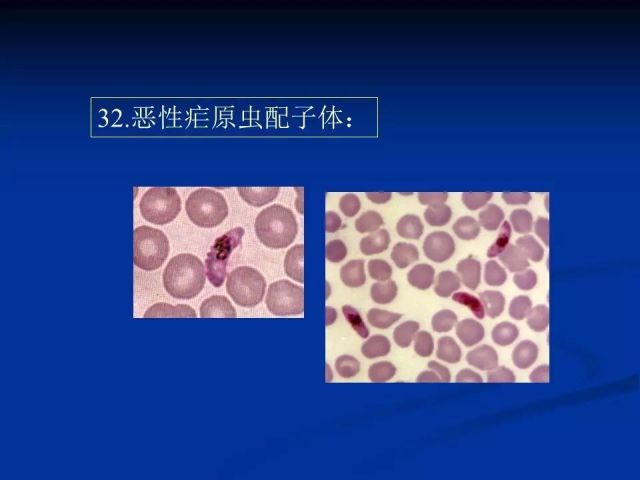 收藏！寄生虫图谱大全
