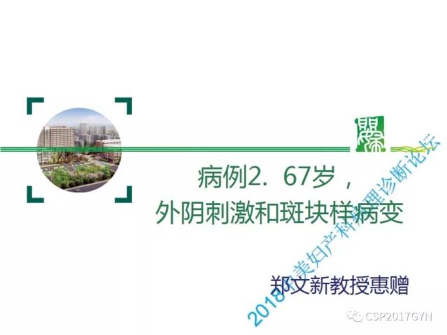 非HPV相关的外阴鳞状细胞肿瘤