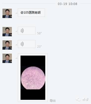 High grade nested variant Urothelial carcinoma(老胡分享，孔祥田老师讲解)