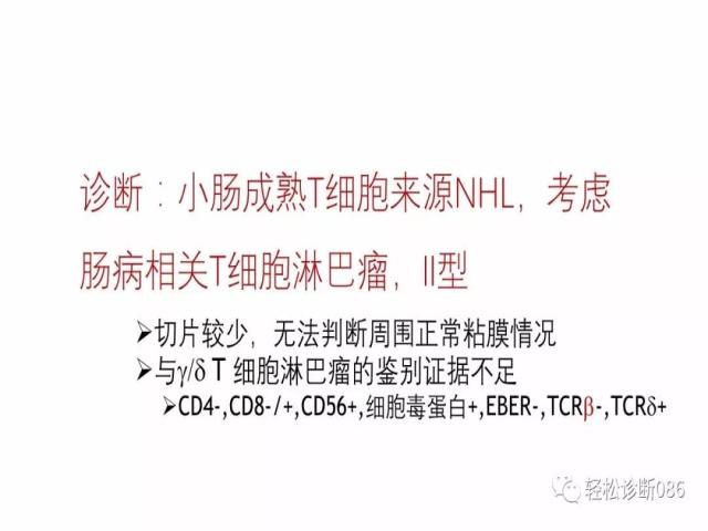 肠道T细胞淋巴瘤