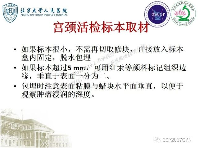 中华病理学会基层培训遵义站讲座（三）——宫颈鳞状上皮病变的病理诊断与鉴别诊断