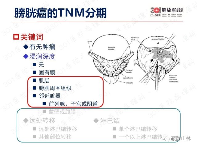 泌尿系统常见肿瘤标本病理报告规范