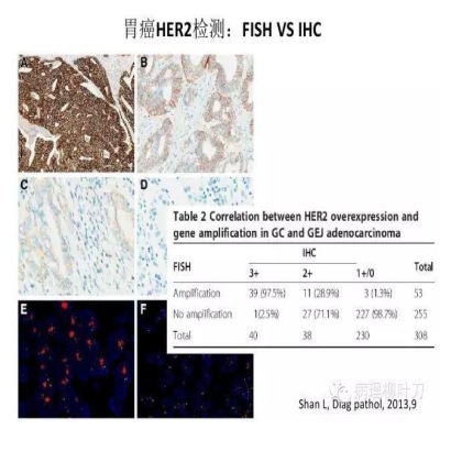 肿瘤精确医疗与分子病理检测