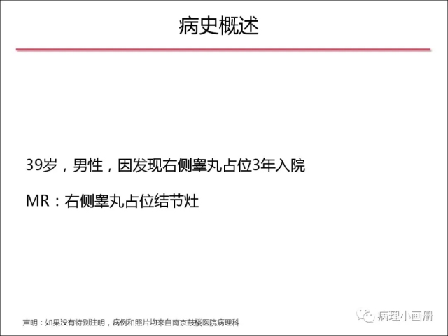 泌尿病理--精原细胞瘤VS精母细胞瘤