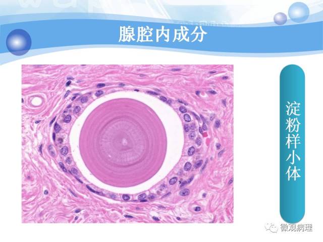 正常前列腺组织学