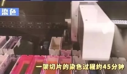 【名医】是不是肿瘤怎么判断?揭秘病理报告出炉全过程! 【名医】是不是肿瘤怎么判断?揭秘病理报告出炉全过程!