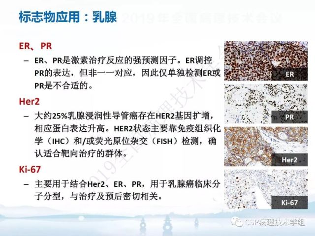 免疫组化检测的临床应用与质量评估