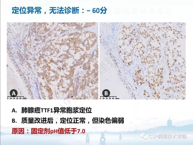免疫组化检测的临床应用与质量评估