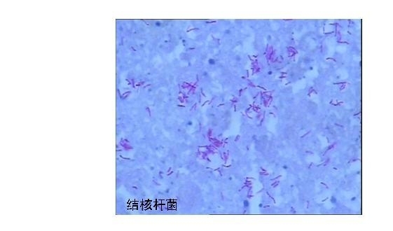特殊染色室内质量控制