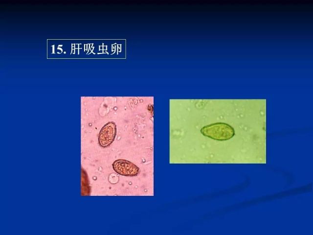 收藏！寄生虫图谱大全
