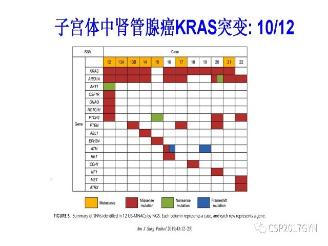 妇科肿瘤病理新进展——特殊类型的腺癌