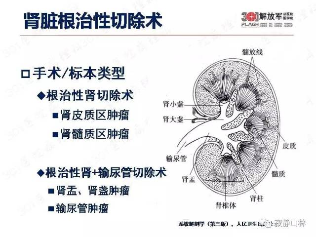 泌尿系统常见肿瘤标本病理报告规范