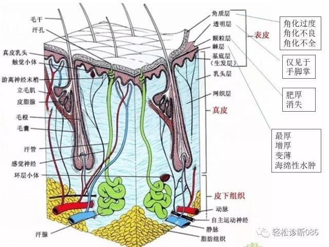 皮肤T细胞淋巴瘤