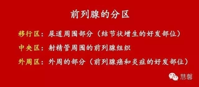 前列腺电切标本出现的非前列腺、非精囊腺组织是什么？原因何在？（张睿病例分享，孔祥田(Max)*Roswell*NM老师讲解）