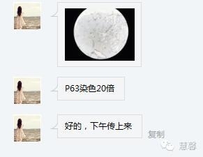 前列腺腺癌？（芳分享病例，华夏泌尿群讨论，孔祥田老师讲解）